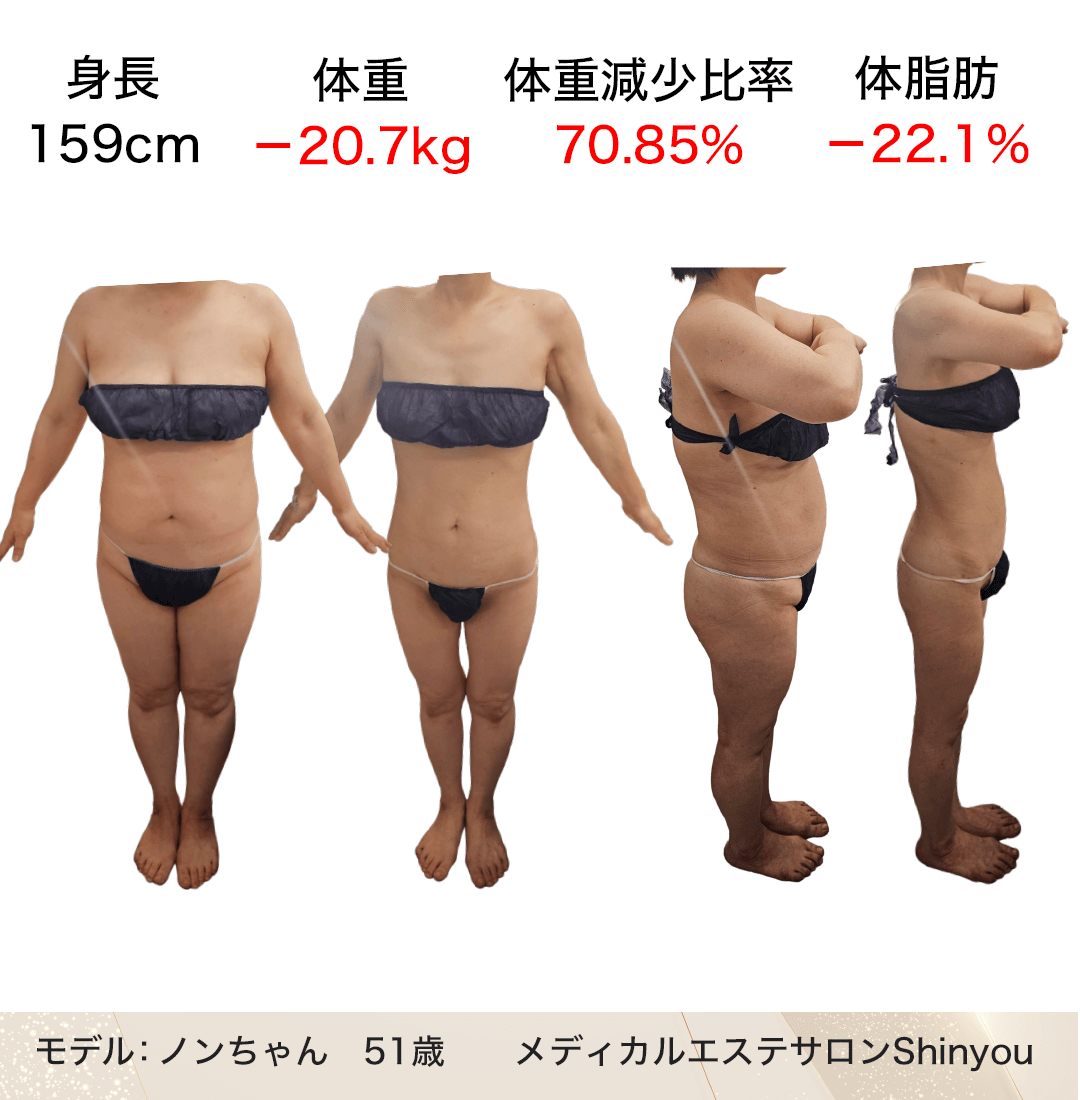 第16回ボディ結果出し部門グランプリ